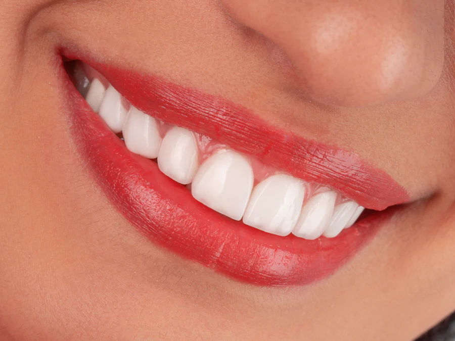 Sorriso de perto com dentes brancos
